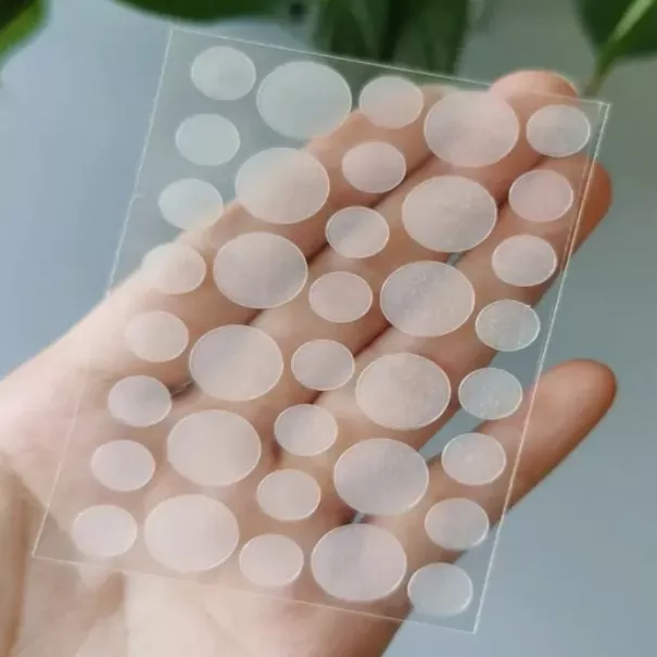 Acne plekken