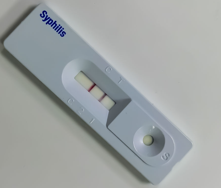 Syphilis Antigen Rapid Test Strip
